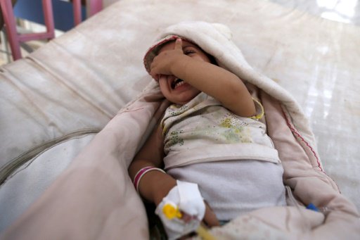 طفل يمني يشتبه باصابته بالكوليرا في احد مستشفيات ص