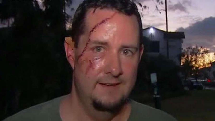 Man survives bear attack with 41 stitches across h