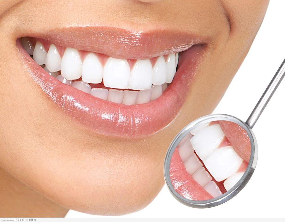  5 طرق طبيعية للتخلص من ترسبات الأسنان