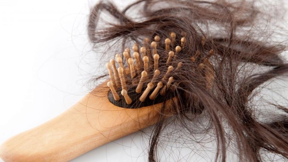 12 سببًا غير معروف لتساقط الشعر .. منها جراحات إنق