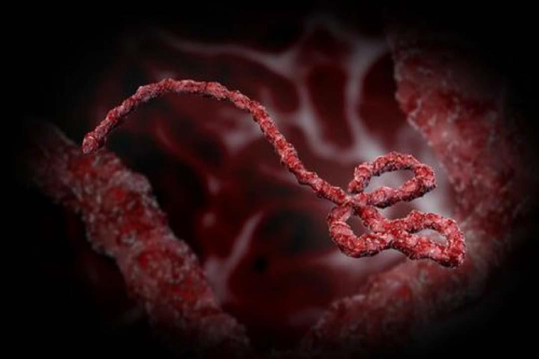 فيروس إيبولا                                      