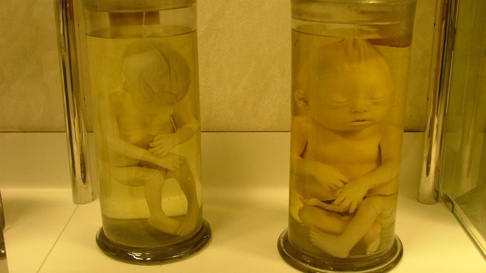 عثر عمال نظافة على جثث عدد من الرضع محفوظة في زجاج