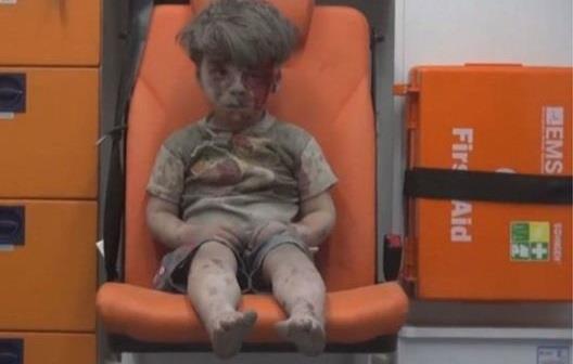  الطفل السوري عمران الذي أُنقذ من تحت الأنقاض