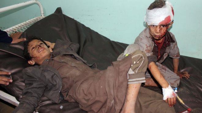 مستشفى في صعدة أعلن استقبال عشرات القتلى والمصابين
