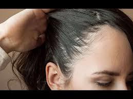 7نصائح لحماية الشعر من التساقط والصلع..منها عدم ال