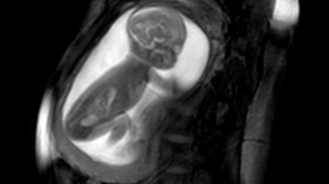 فحصت النساء الحوامل بجهاز تصوير الرنين المغناطيسي 
