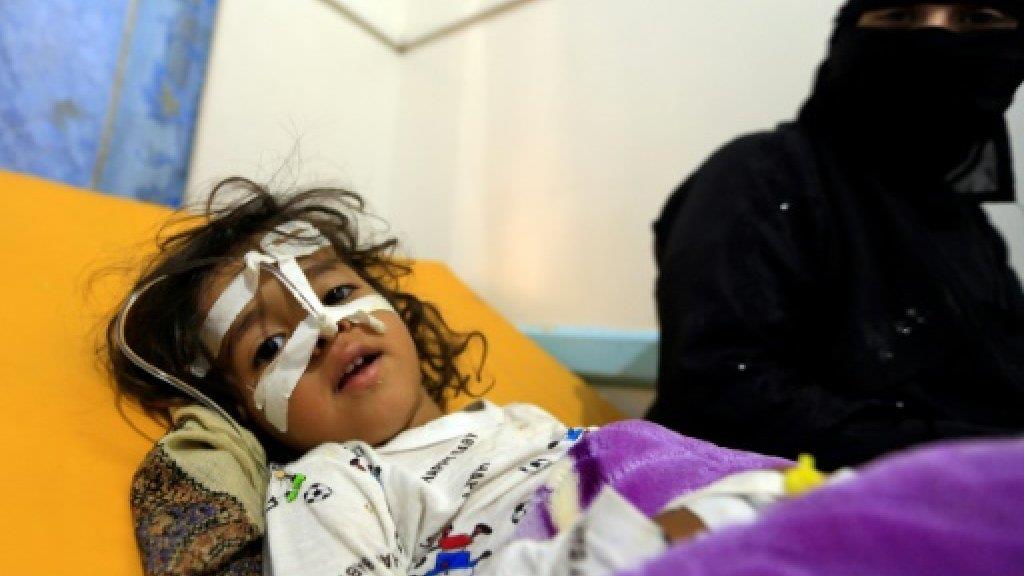 طفلة يمنية تتلقى العلاج من الكوليرا في العاصمة الي