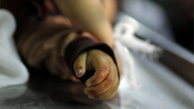 صورة من المشرحة لجثمان الطفلة صبا محمود أبو عرار