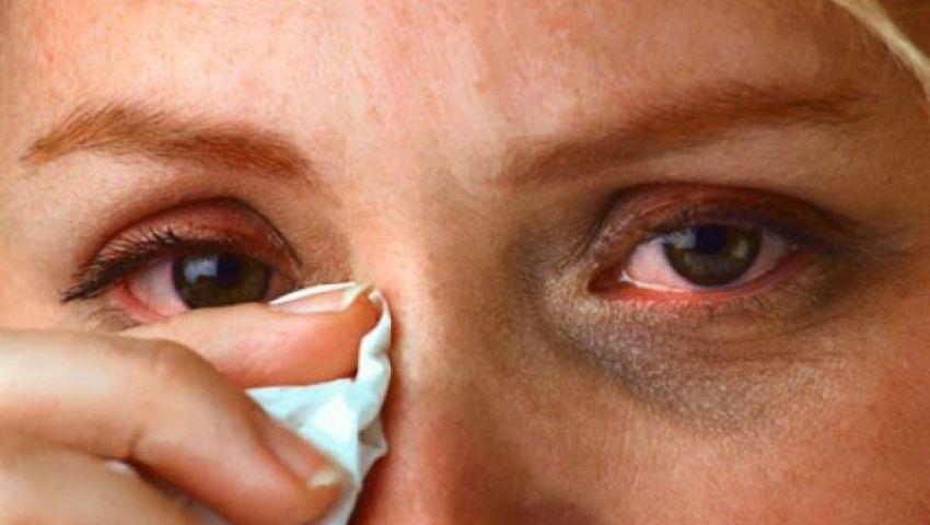 تعرف على أعراض إنفلونزا العيون؟ 
