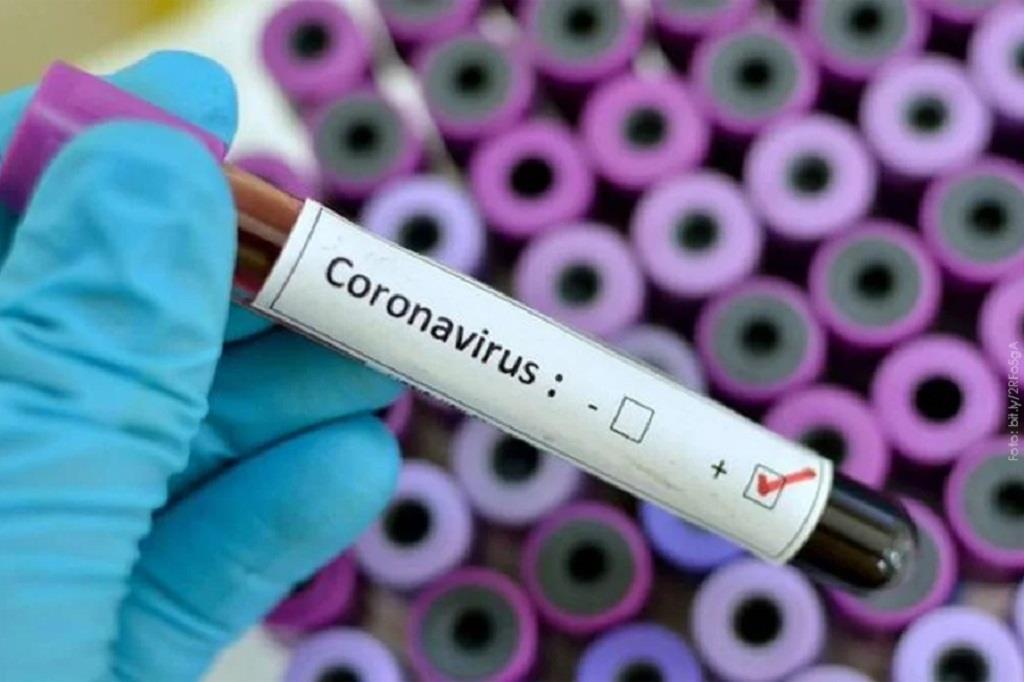 السويد تعلن أول حالة إصابة مؤكدة بفيروس كورونا 
