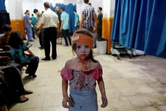 طفلة سورية مصابة في مستشفى ميداني في دوما شرق دمشق