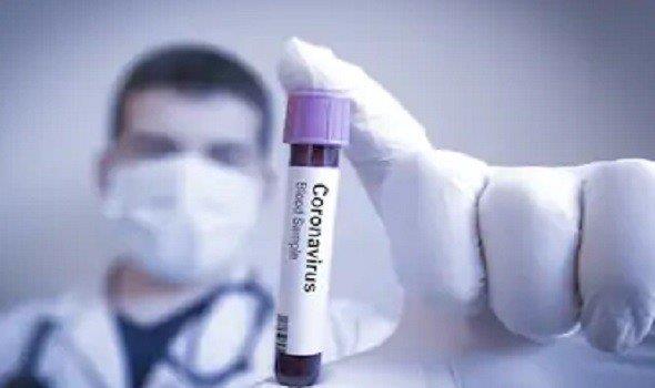 فرنسا تقر علاجا مؤقتا لفيروس كورونا