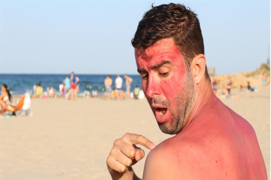 نصائح لحماية الجلد على الشواطئ