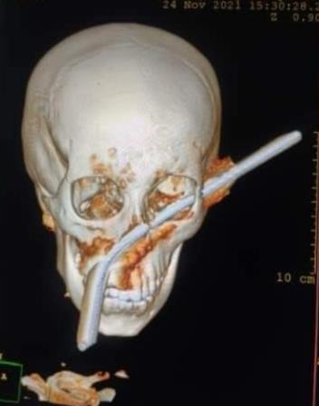 IMG_٢٠٢١١١٢٥_١٢٤١١٤