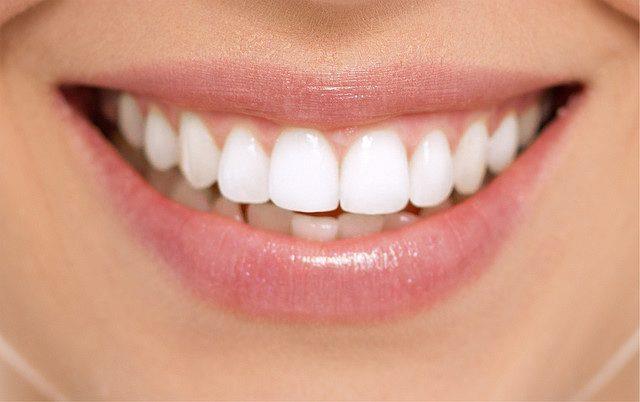 طرق طبيعية لعلاج تسوس وتجويف الأسنان