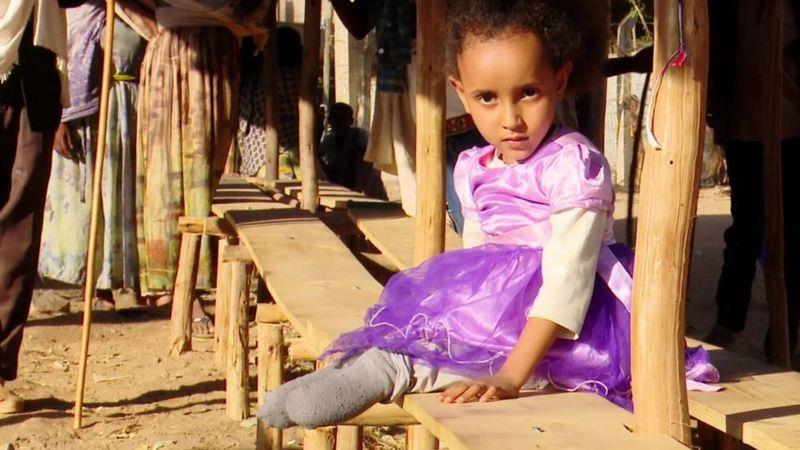 بيت لحم تسفايي، 6 سنوات، خسرت قدميها خلال الصراع