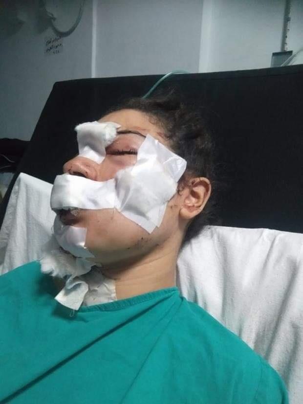 إسراء عماد ضحية عنف زوجها بالإسكندرية 