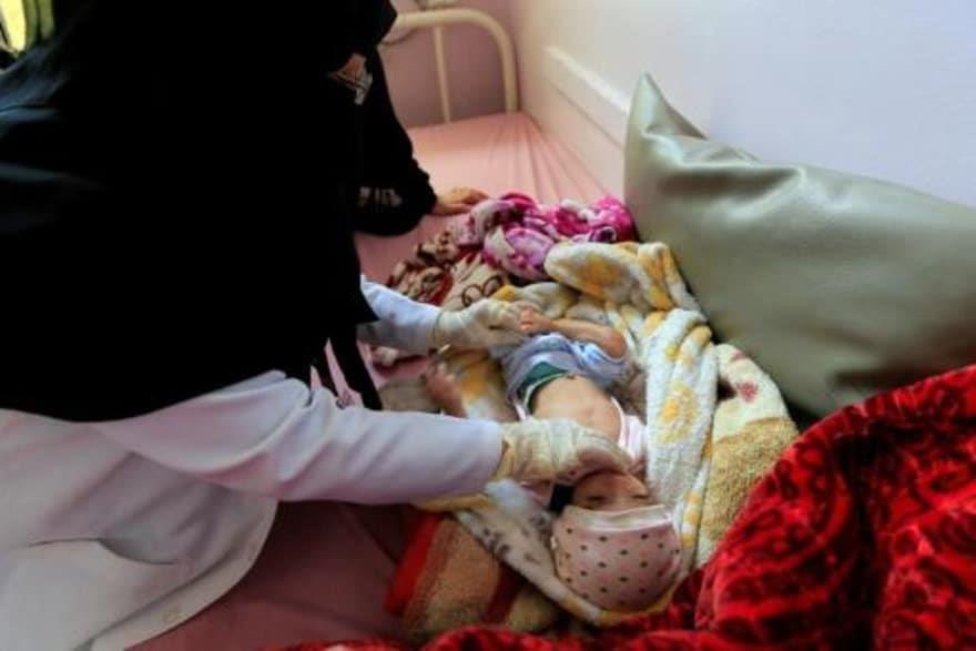 ممرضة تعالج طفلا يعاني من سوء التغذية في مستشفى ال