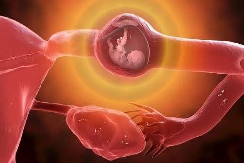 خطر حدوث الحمل خارج الرحم