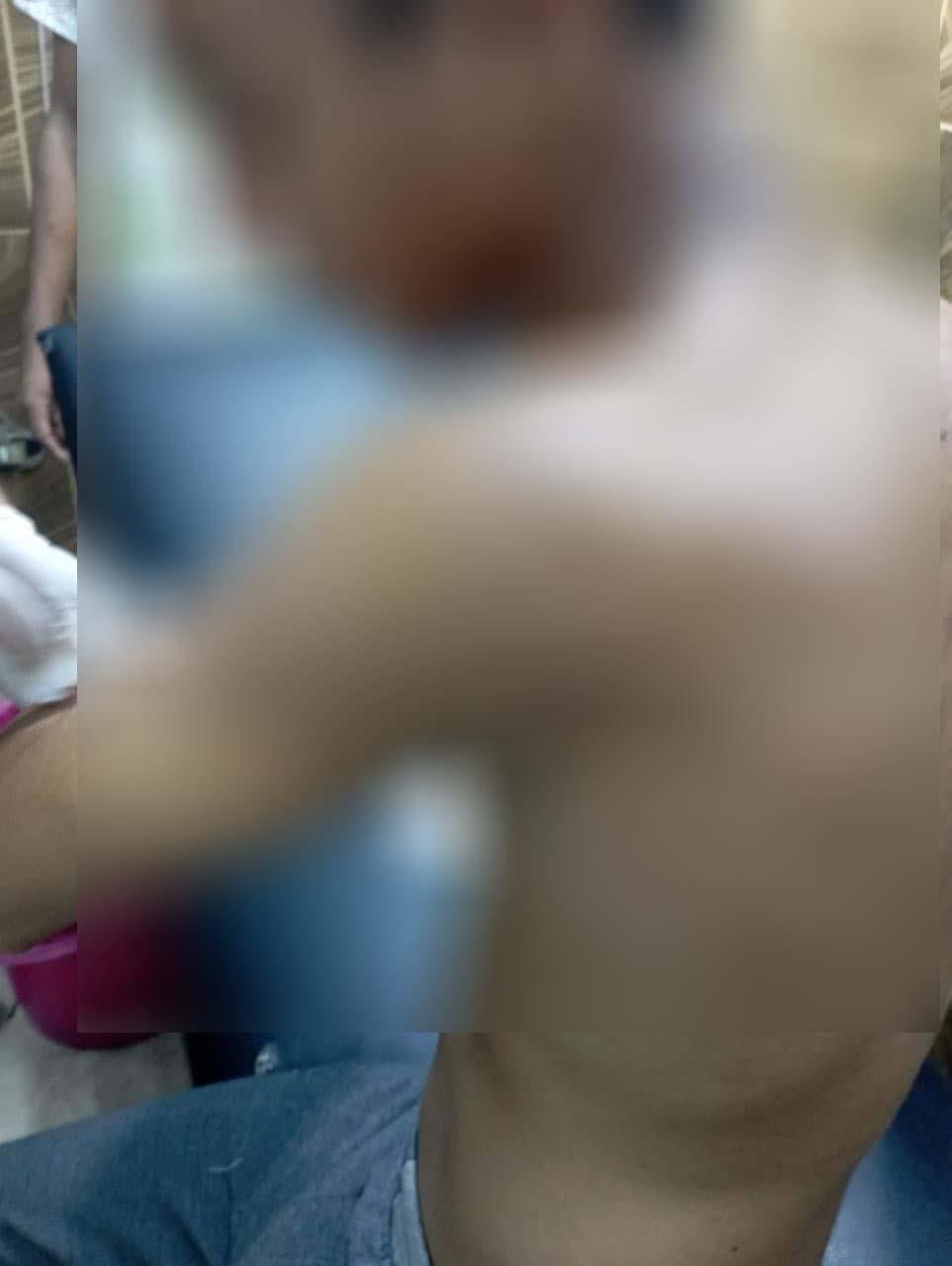 إصابة طالب في مشاجرة بالقليوبية