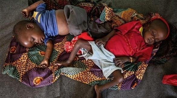 ارتفاع حصيلة وفيات الحصبة في زيمبابوي إلى 685 شخصً