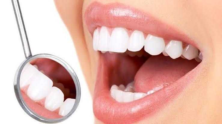كيف يمكن مواجهة تسوس الأسنان؟