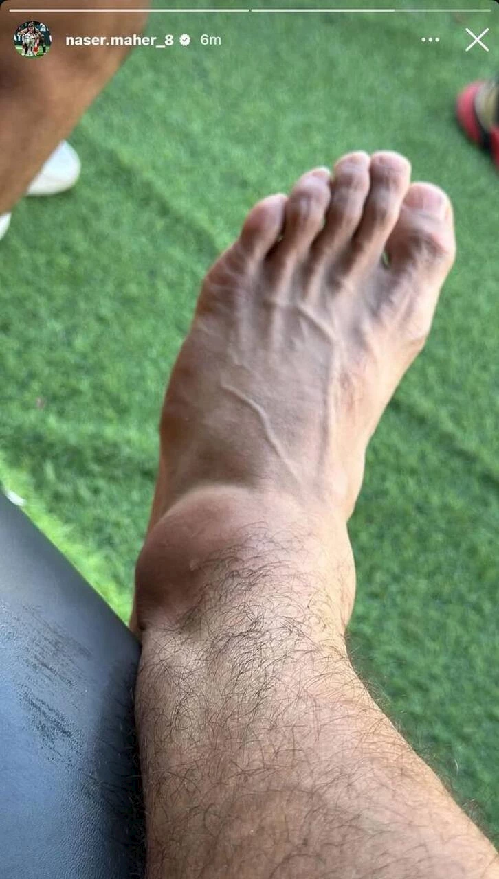 إصابة ناصر ماهر