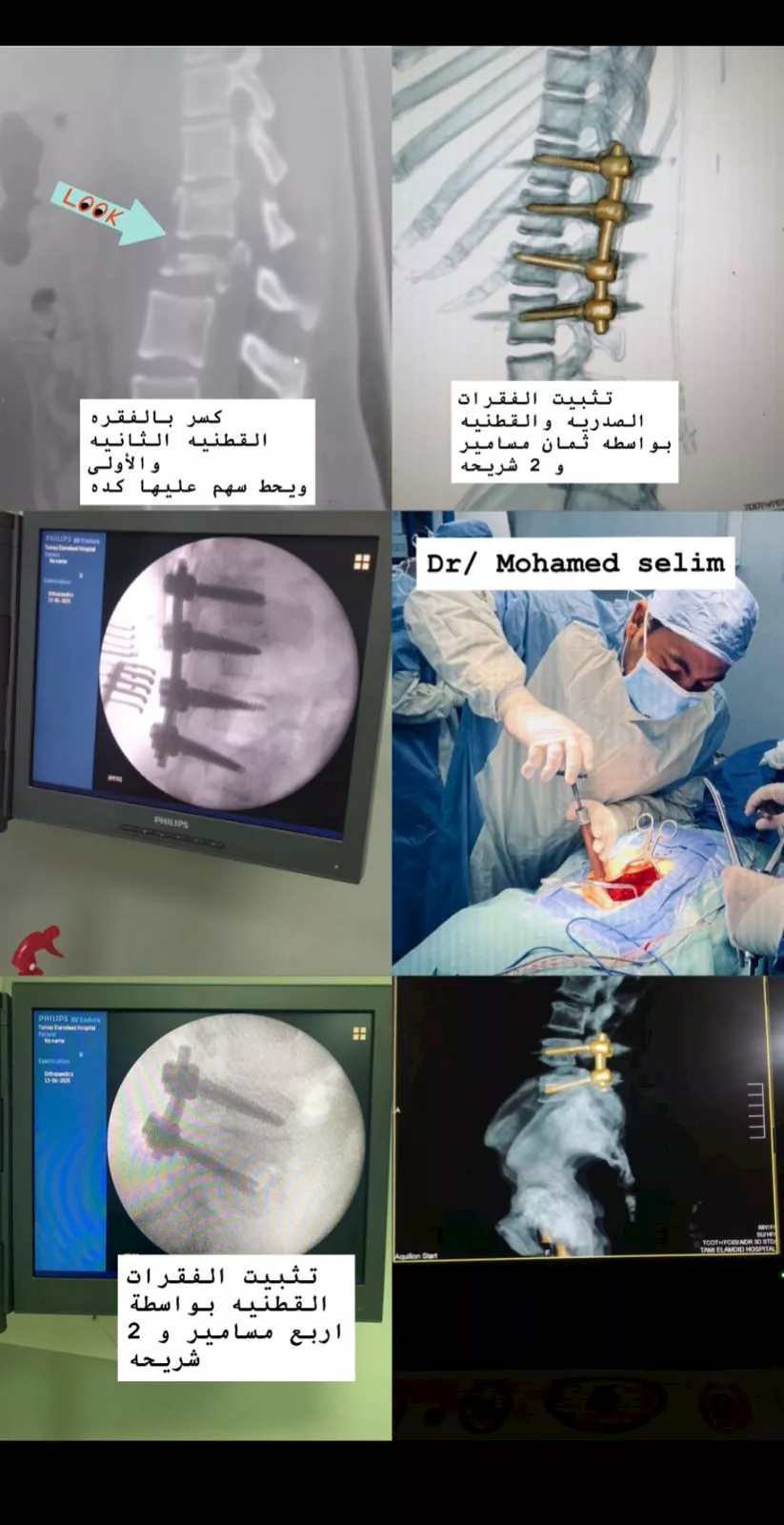  جراحات دقيقة تنقذ 3 مريضات من الشلل بمستشفى تمي الأمديد بالدقهلية