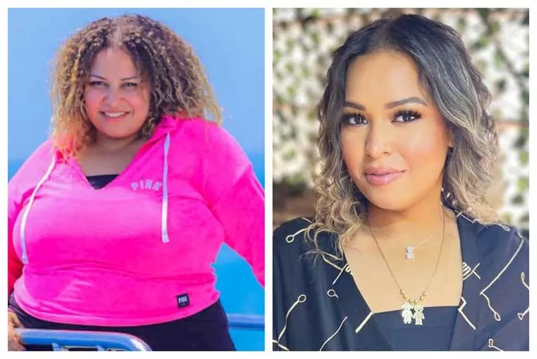 20 صورة لنجمة مسرح مصر قبل وبعد التخسيس