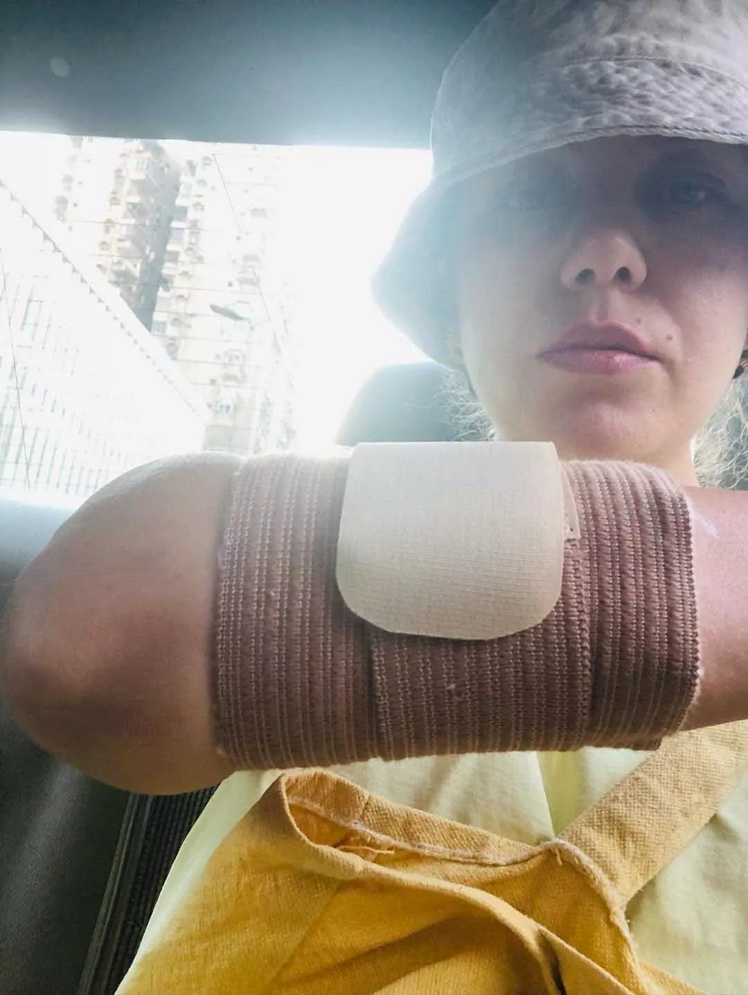 رحمة حسن تتعرض لإصابة جديدة_6