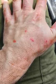 صورة 2 جنود الاحتلال