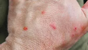 صورة 4 جنود الاحتلال