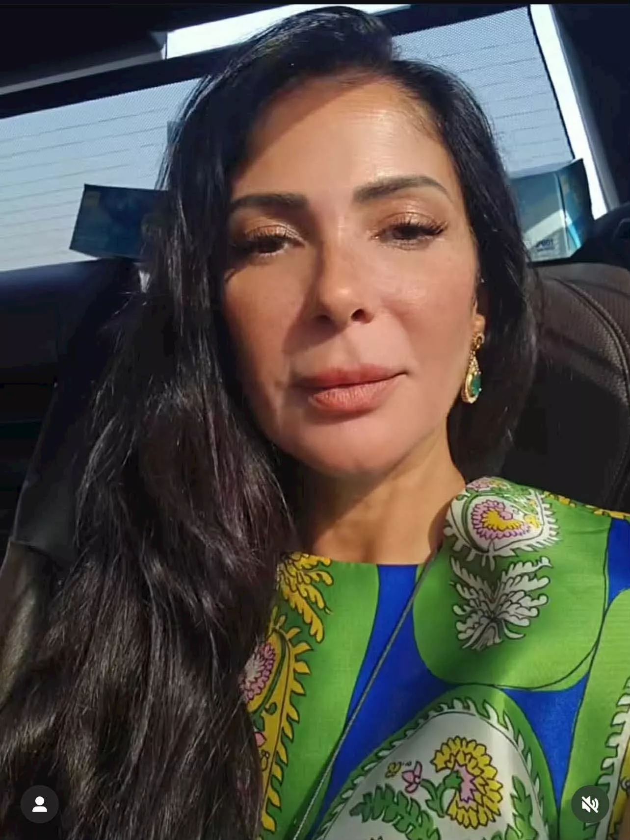 منى زكي تُجري تعديلات تجميلية في الوجه