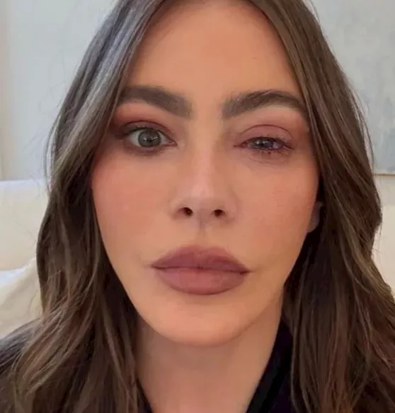 بعين متورمة.. ممثلة شهيرة تكشف السبب وراء عدم حضور حفل الإيمي 2025 1