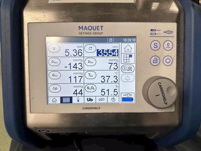 قصر العيني يسجل سابقة طبية تنقذ مريضة من خطر محقق