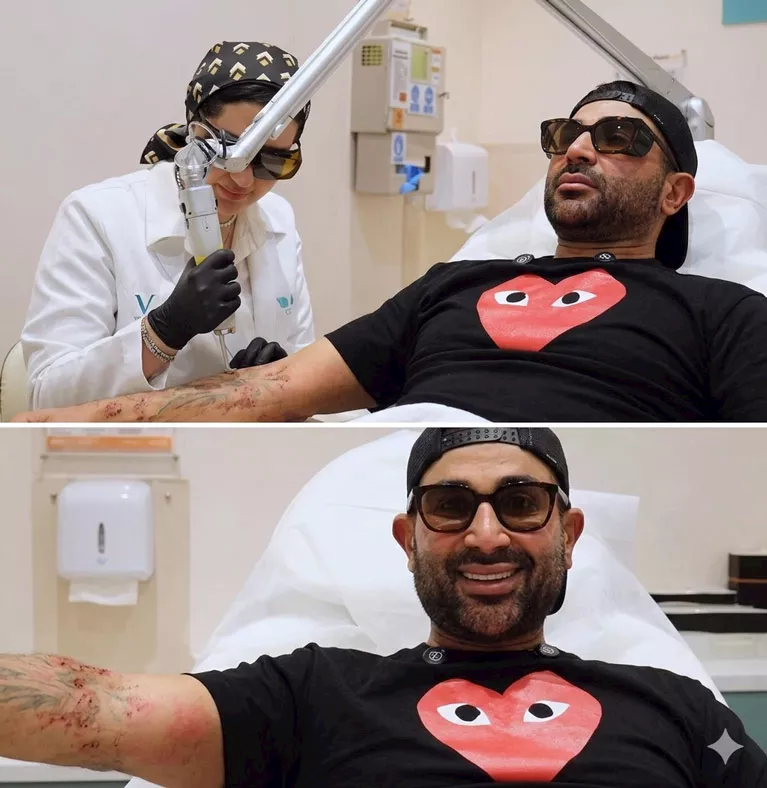 احمد سعد يحتفل بازالة التاتو