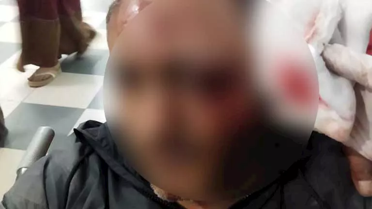 مصاب آخر في حادث تلا