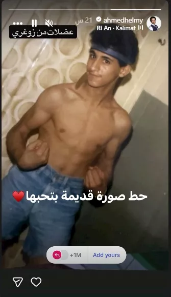 أحمد حلمي في مراحة المراهقة