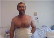 المريض بعد اجراء العملية