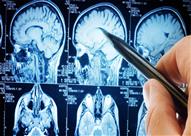  مفاجأة محزنة.. اكتشاف علاقة بين الشهادات الجامعية