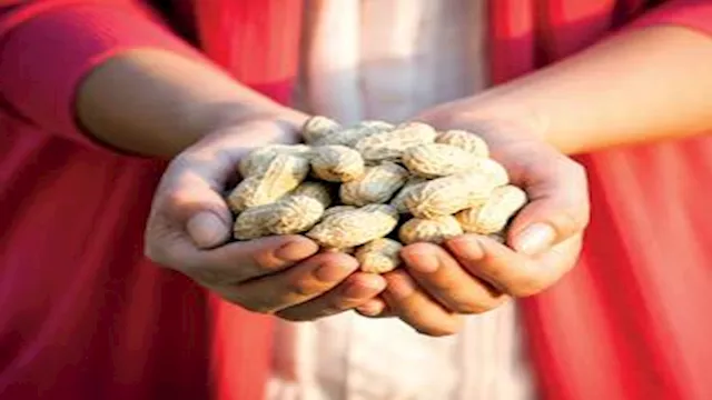 دراسة: لصقة الفول السوداني قد تحمي الأطفال من حساس