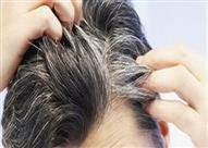 الشعر الأببض