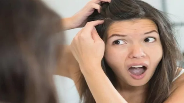 الشيب المبكر