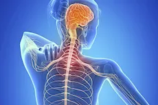 دراسة: تلف الحمض النووي قد يفسر تدهور الدماغ في التصلب المتعدد