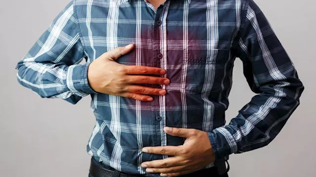 حرقة المعدة