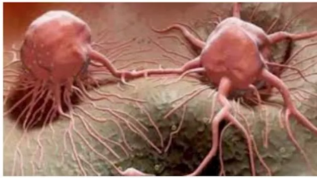 خلايا سرطانية