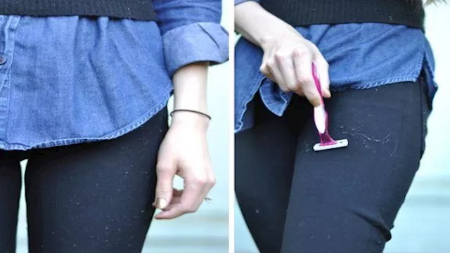 إزالة الوبرة