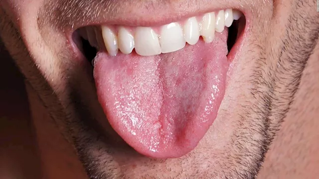 علامة في اللسان والذاكرة مؤشر خطير لنقص فيتامين مه