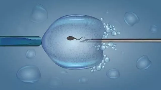 تحديد جنس الجنين                                  