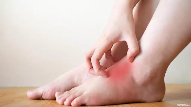 بينها أمراض الكبد.. حكة القدم قد تكشف مشاكل صحية خ